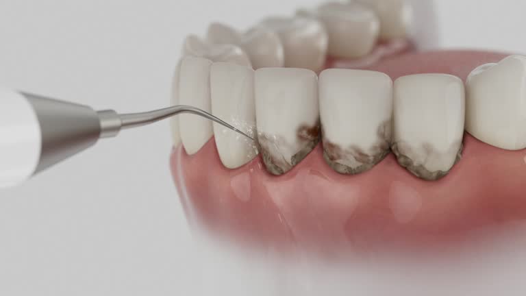 Trusted Wisdom Tooth Removal service in Williamsville, IL - Dentist Open Now